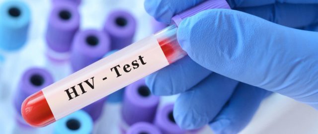 Seniorzy a HIV. Jak często dochodzi do zakażeń? Jak się kochać długo i zdrowo?